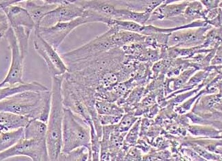 U87-MG-LUC-PURO人脑胶质瘤细胞（荧光示踪细胞）+LUC U87-MG-LUC-PURO Human glioma cells+LUC