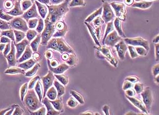 HELA-LUC-PURO人子宫颈癌细胞(荧光示踪细胞)+LUC HELA-LUC-PURO human cervical cancer cells+LUC
