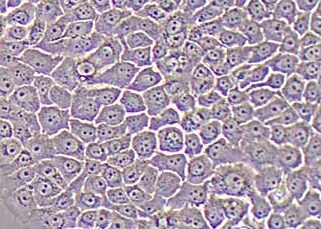 BXPC-3-LUC-PURO人胰腺腺癌细胞（荧光示踪细胞）+LUC BXPC-3-LUC-PURO human pancreatic adenocarcinoma cells+LUC