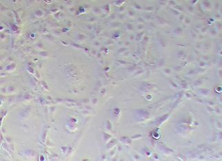 MKN-7-LUC 人胃癌细胞（荧光示踪细胞）+luc MKN-7-LUC human gastric cancer cells+luc