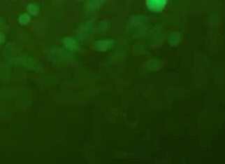 RKO-LUC-EGFP人结肠腺癌细胞(荧光示踪细胞) RKO-LUC-EGFP human colon adenocarcinoma cells
