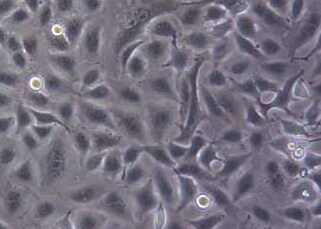 A549+RFP人肺癌细胞(荧光示踪细胞)+RFP A549+RFP human lung cancer cells+RFP
