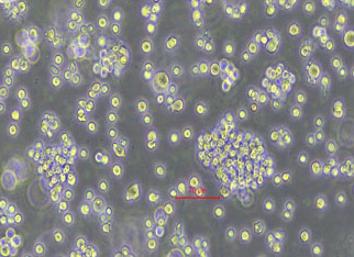 Raji-LUC-puro人淋巴瘤细胞（荧光示踪细胞）+LUC Raji LUC puro human lymphoma cells+LUC