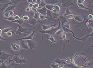 SK-BR-3-LUC-PURO人乳腺癌细胞（荧光示踪细胞）+LUC SK-BR-3-LUC-PURO human breast cancer cell+LUC