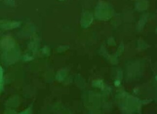 NCI-H1975-LUC-EGFP人肺腺癌细胞(荧光示踪细胞) NCI-H1975-LUC-EGFP human lung adenocarcinoma cells