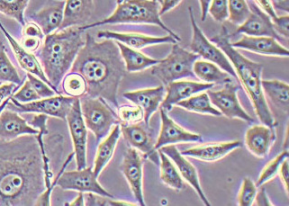 PC-3-LUC-PURO人前列腺癌细胞（荧光示踪细胞）+luc PC-3-LUC-PURO human prostate cancer cells+luc