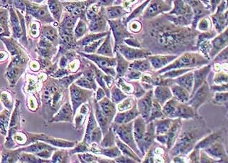 A375-eGFP人恶性黑色素瘤细胞（荧光示踪细胞）+eGFP A375 eGFP human malignant melanoma cells+eGFP