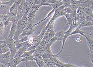 T47D-LUC-PURO人乳腺癌细胞（荧光示踪细胞）+LUC T47D-LUC-PURO human breast cancer cell+LUC