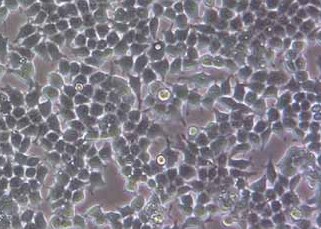 293T-LUC-puro人胚肾细胞(荧光示踪细胞)+LUC 293T LUC puro human embryonic kidney cells+LUC