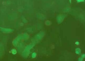 MCF-7-LUC-EGFP人乳腺癌细胞（荧光示踪细胞） MCF-7-LUC-EGFP human breast cancer cells