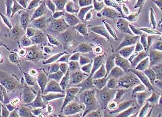 SIHA-LUC-PURO人子宫颈鳞癌细胞（荧光示踪细胞）+luc SIHA-LUC-PURO human cervical squamous cell carcinoma cells+luc