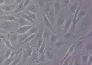 786-O-plv-luc-BSD人肾癌细胞（荧光示踪细胞） +luc 786-O-plv-luc-BSD human kidney cancer cells+luc