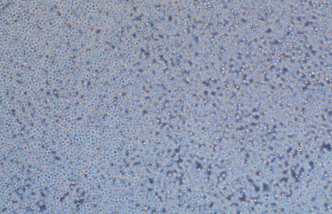 HL-60-LUC人早幼粒白血病细胞(荧光示踪细胞)+LUC HL-60-LUC human promyelocytic leukemia cells+LUC