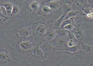 T24-LUC人膀胱癌细胞（荧光示踪细胞）+LUC T24-LUC human bladder cancer cells+LUC