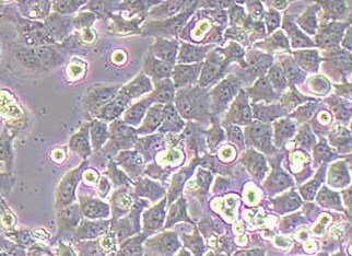 Caov3-LUC-PURO人卵巢癌细胞（荧光示踪细胞）+LUC Caov3 LUC-PURO human ovarian cancer cells - luciferase labeling