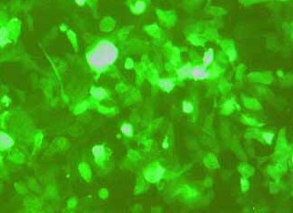 HCT116-GFP人结肠癌细胞（荧光示踪细胞）+GFP