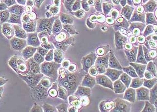 CNE2-LUC-PURO人鼻咽癌细胞（荧光示踪细胞）+luc CNE2-LUC-PURO human nasopharyngeal carcinoma cells+luc