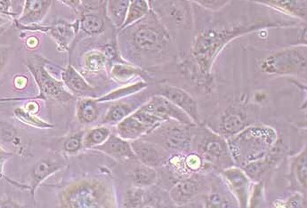 小鼠肺癌鳞癌细胞系KLN205 Mouse lung cancer squamous cell carcinoma KLN205