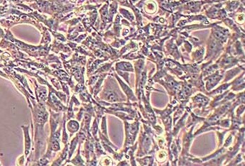 小鼠耳蜗毛细胞系HEI-OC1（种属鉴定） HEI-OC1 mouse cochlear hair cell line