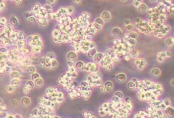 小鼠B细胞淋巴瘤A20（种属鉴定） Mouse B-cell lymphoma A20