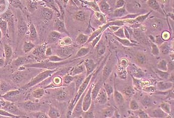 小鼠胰岛内皮细胞系MS1（种属鉴定） Mouse islet endothelial cells MS1