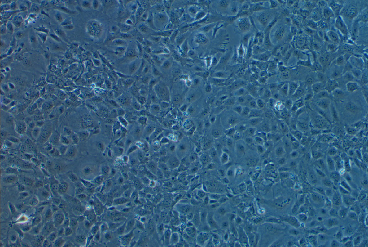 小鼠肝枯否(kupffer)细胞-永生化 Kupffer cells in mouse liver - immortalized