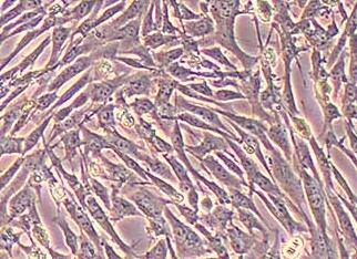 小鼠卵巢颗粒细胞永生化 Immortalization of mouse ovarian granulosa cells