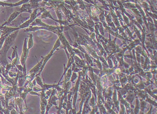 小鼠肺动脉平滑肌细胞永生化 Immortalization of mouse pulmonary artery smooth muscle cells