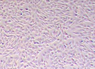 小鼠胰腺星状细胞永生化 Immortalization of mouse pancreatic stellate cells