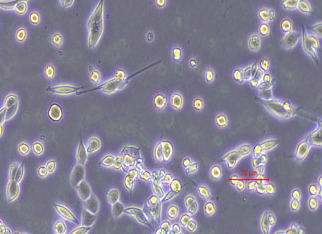 小鼠肺癌细胞转染LLC+OVA Transfection of mouse lung cancer cells with LLC+OVA