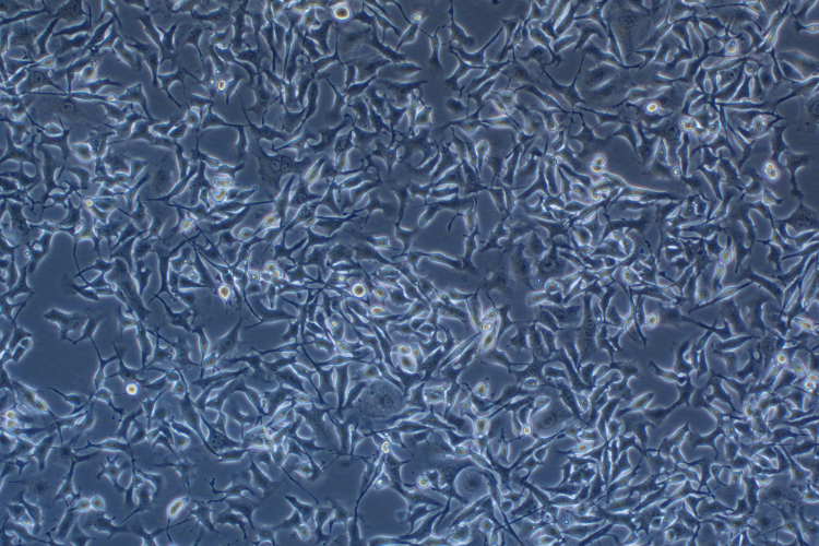 小鼠黑色素瘤细胞转染B16-F10+OVA（种属鉴定） Transfection of B16-F10+OVA into mouse melanoma cells