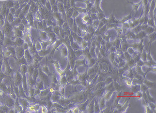 小鼠乳腺癌细胞转染4T1+OVA(STR鉴定正确) Transfection of 4T1+OVA into mouse breast cancer cells