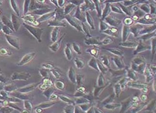 4T1 (小鼠乳腺癌细胞系) (STR鉴定正确) 4T1 (mouse breast cancer cell) (STR identification correct)