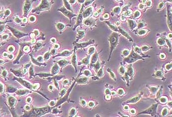 WEHI 164 (小鼠纤维肉瘤细胞系) WEHI 164 (Mouse Fibrosarcoma Cells)