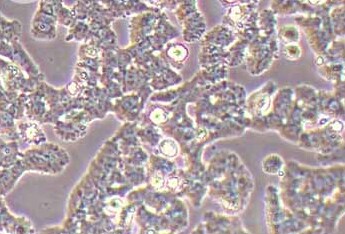 MA-891 (小鼠乳腺癌高转移细胞系) MA-891 (mouse breast cancer highly metastatic cells)