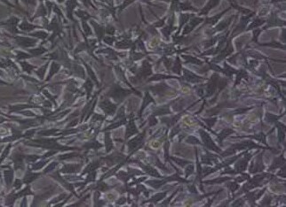 RM-1 (小鼠前列腺癌细胞系) (STR鉴定正确) RM-1 (mouse prostate cancer cells) (STR identification correct)