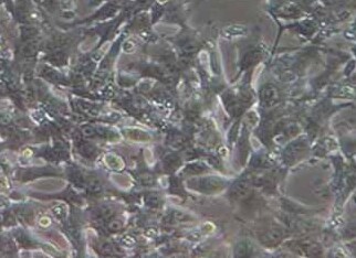 Hepa 1-6 (小鼠肝癌细胞系) (STR鉴定正确) Hepa 1-6 (mouse liver cancer cells) (STR identification correct)