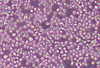 L1210 (小鼠白血病细胞系) (STR鉴定正确) L1210 (mouse leukemia cells)