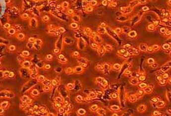 NCTC clone 1469小鼠肝上皮细胞系 NCTC clone 1469 mouse liver epithelial cells