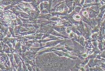 TM4正常小鼠睾丸Sertoli细胞系 TM4 normal mouse testicular Sertoli cells