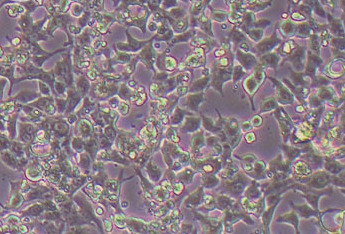 HL-1 (小鼠心肌细胞系) (种属鉴定正确) HL-1 (Mouse Cardiomyocyte) (species identification correct)