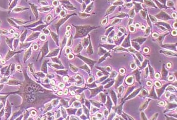L Wnt-3A (小鼠皮下结缔组织细胞系) (STR鉴定正确) L Wnt-3A (mouse subcutaneous connective tissue cells)