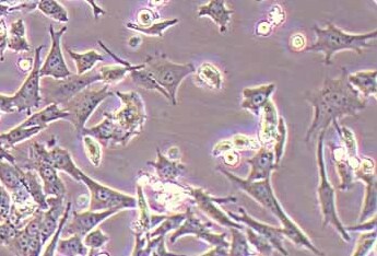 HT22 (小鼠海马神经元细胞系) (STR鉴定正确) Hippocampal Neurons