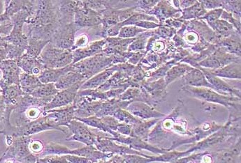 MEF小鼠胚胎成纤维细胞系 (丝裂霉素C处理) MEF mouse embryonic fibroblasts (treated with mitomycin C)