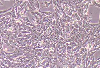P19 [P-19] (小鼠畸胎瘤细胞系) (STR鉴定正确) P19 [P-19] Mouse Embryonal Carcinoma Cells (EC)