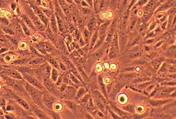 SV40-MES-13小鼠肾小球系膜细胞系 SV40-MES-13 mouse glomerular mesangial cells