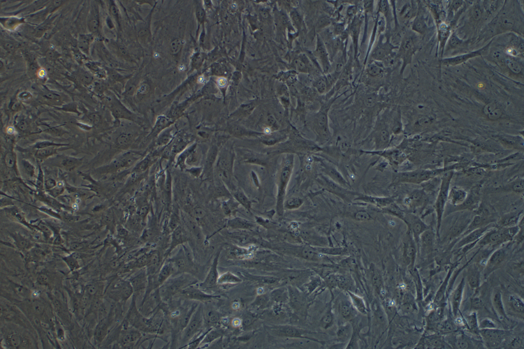 MEF小鼠胚胎成纤维细胞系 MEF mouse embryonic fibroblasts