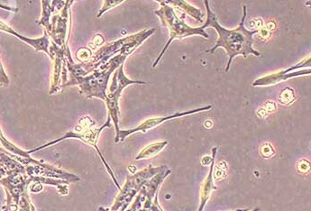 C8-D1A (小鼠小脑组织细胞系)(STR鉴定正确) C8-D1A (Mouse cerebellar tissue cells)