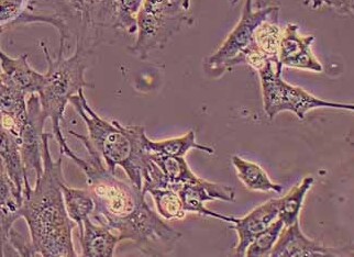 MPC-1小鼠附睾近头端上皮细胞系(永生化细胞) MPC-1 immortalized mouse epididymal proximal epithelial cell line