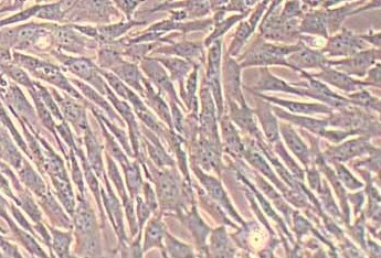 小鼠附睾脂肪干细胞(永生化细胞) Mouse epididymal adipose stem cells (immortalized)